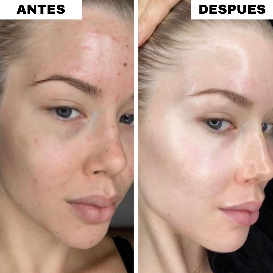 Cepillo Limpiador Facial (2x1)