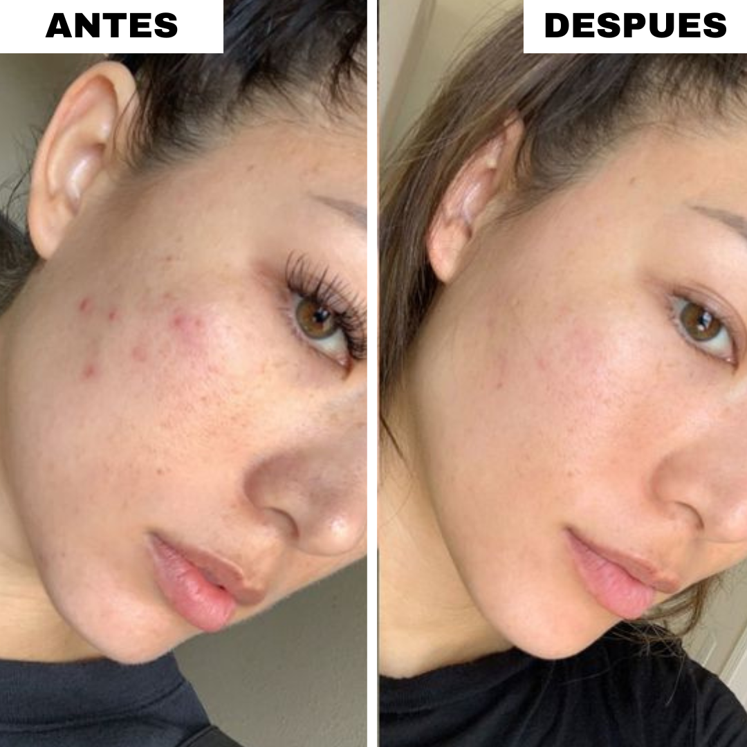 Cepillo Limpiador Facial (2x1)