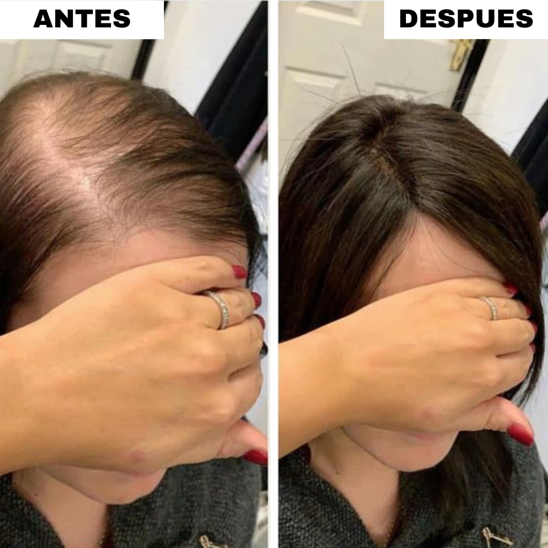 Gorro de Seda Anticaída (3x1)
