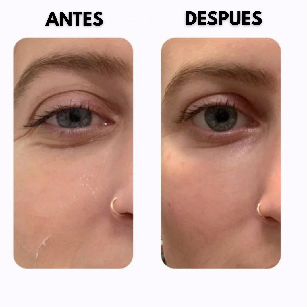 Mascarilla de colágeno Anti-Ojeras 10 Parches + 10 Parches de Regalo + Espray