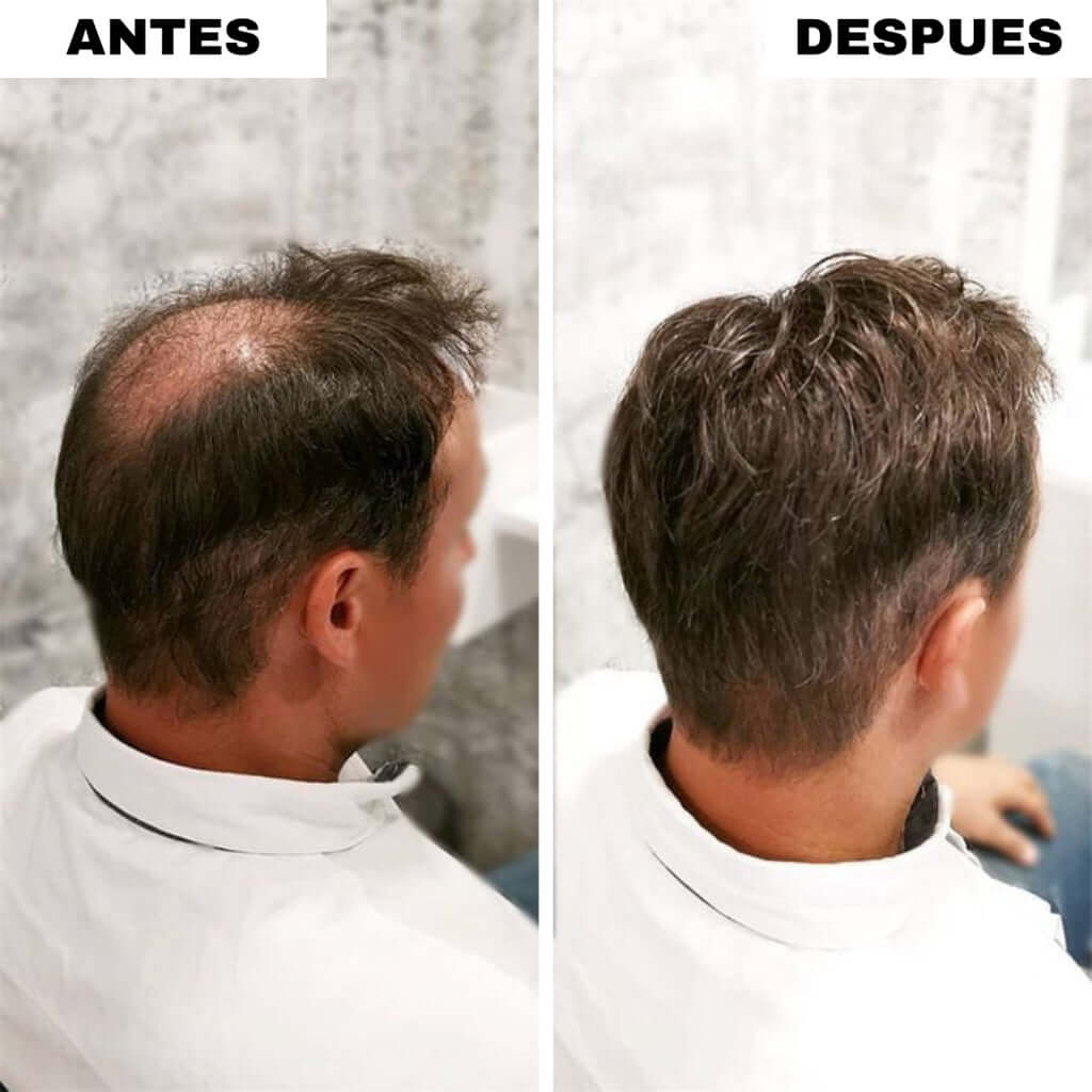 RELLENO CAPILAR INSTANTANEO - OFERTA 2X1 + 2 GRATIS