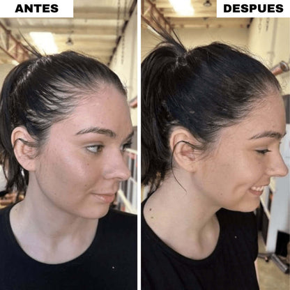 RELLENO CAPILAR INSTANTANEO - OFERTA 2X1 + 2 GRATIS