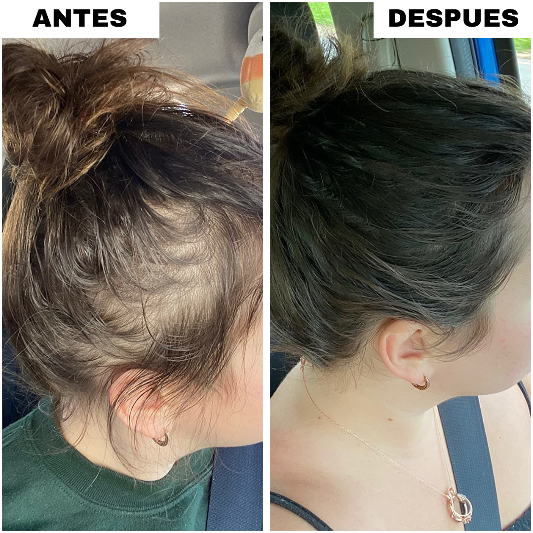 Gorro de Seda Anticaída (3x1)