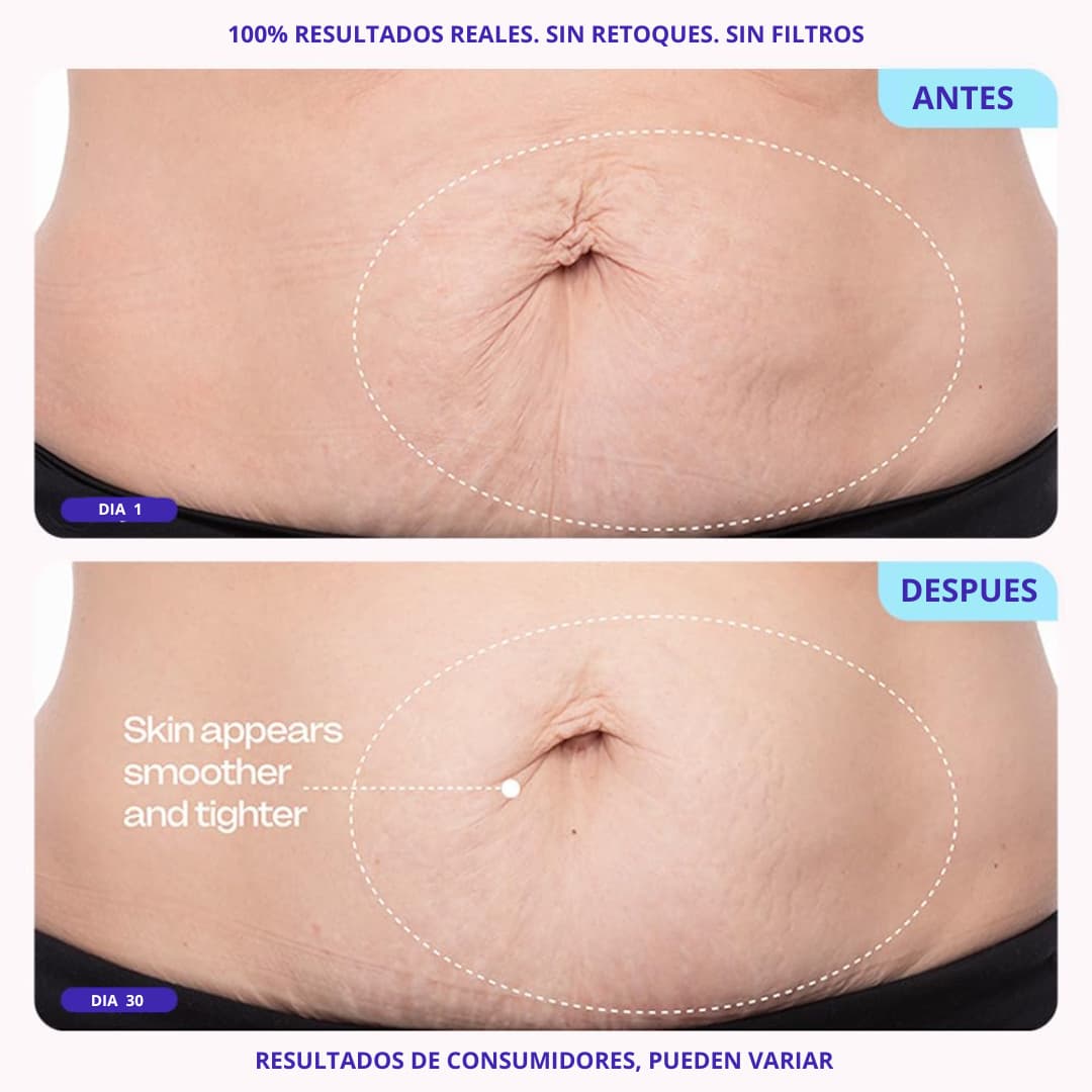 Crema Reafirmante de Vientre (1 + 1  GRATIS)