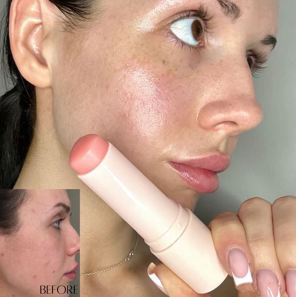 Bálsamo de Colágeno ANTIARRUGAS (1+1 GRATIS) CHECKOUT